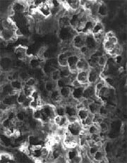 Calcite fragment from cement that was found in pasta at a restaurant